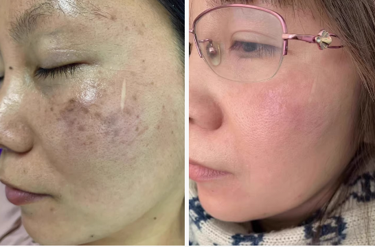 Aglaiwish  КРЕМ ПРОТИ ЗМОРШОК